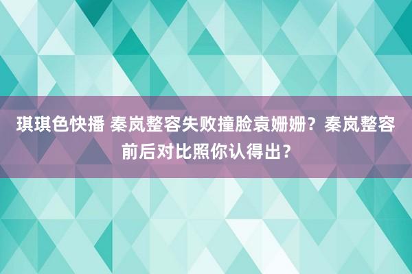 琪琪色快播 秦岚整容失败撞脸袁姗姗？秦岚整容前后对比照你认得出？